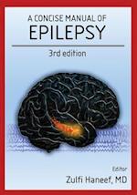 A Concise Manual of Epilepsy