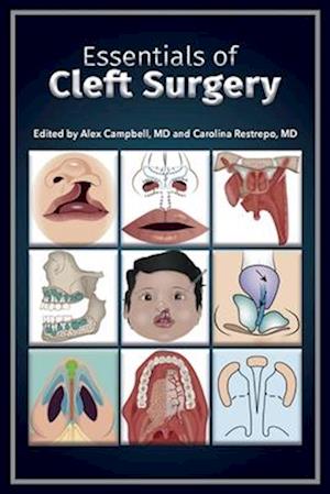 Essentials of Cleft Surgery