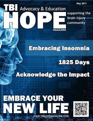 Tbi Hope Magazine - May 2017
