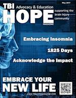 Tbi Hope Magazine - May 2017