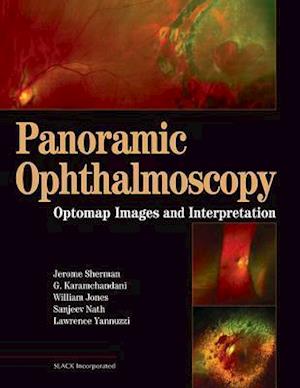 Panoramic Ophthalmoscopy