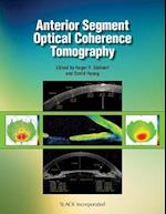 Anterior Segment Optical Coherence Tomography