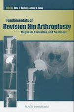 Fundamentals of Revision Hip Arthroplasty