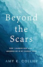 Beyond the Scars