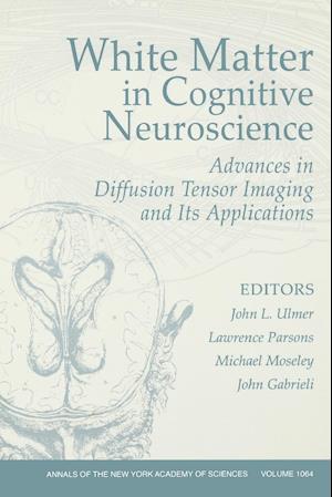 White Matter in Cognitive Neuroscience: Advances in Diffusion Tensor Imaging and Its Applications