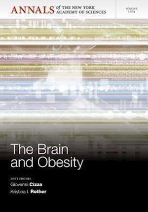 The Brain and Obesity