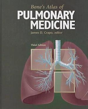 Bone's Atlas of Pulmonary Medicine