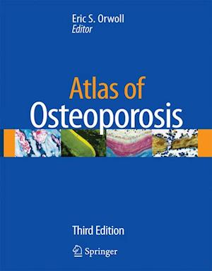 Atlas of Osteoporosis [With CDROM]
