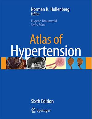 Atlas of Hypertension