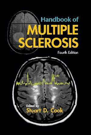 Handbook of Multiple Sclerosis