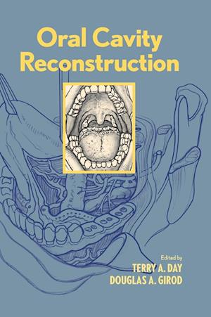 Oral Cavity Reconstruction