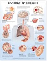 Dangers of Smoking Anatomical Chart