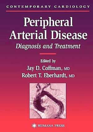 Peripheral Arterial Disease