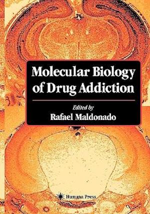 Molecular Biology of Drug Addiction