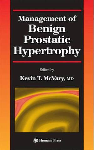 Management of Benign Prostatic Hypertrophy