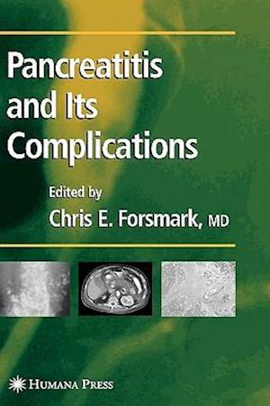 Pancreatitis and Its Complications