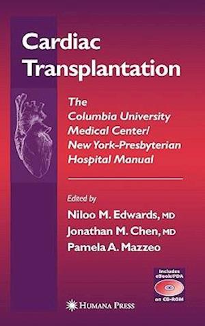 Cardiac Transplantation