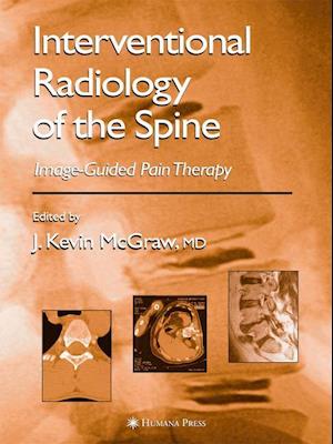 Interventional Radiology of the Spine