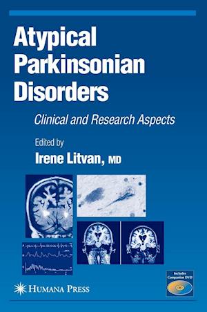 Atypical Parkinsonian Disorders