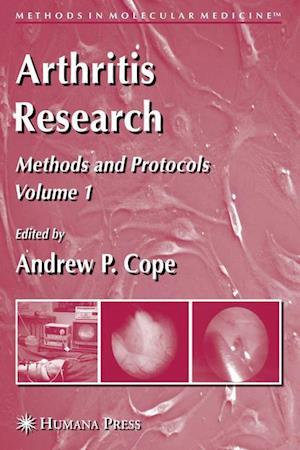 Arthritis Research