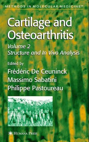 Cartilage and Osteoarthritis