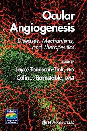 Ocular Angiogenesis