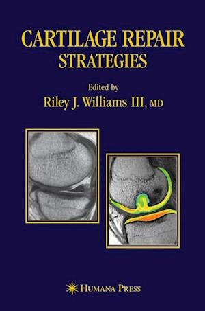 Cartilage Repair Strategies