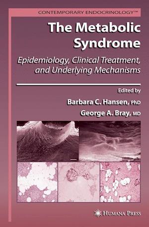 The Metabolic Syndrome: