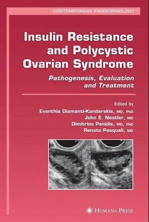Insulin Resistance and Polycystic Ovarian Syndrome