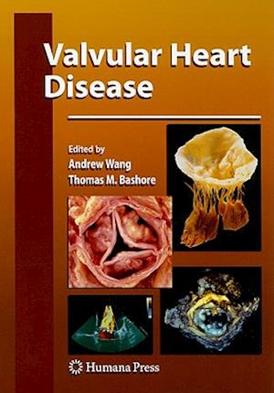 Valvular Heart Disease