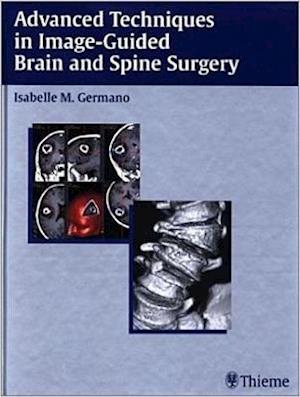 Advanced Techniques in Image-Guided Brain and Spine Surgery