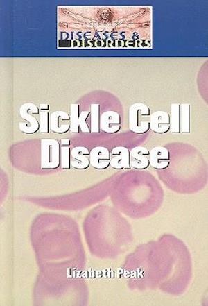 Sickle Cell Disease