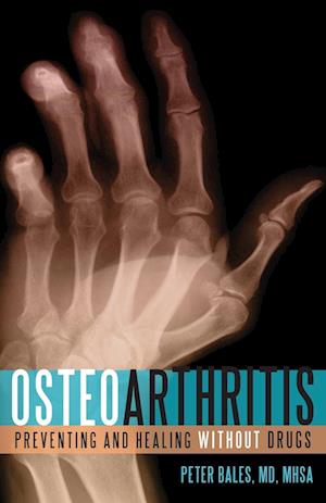 Osteoarthritis