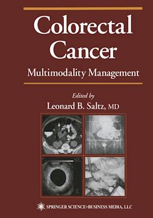 Colorectal Cancer