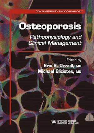 Osteoporosis