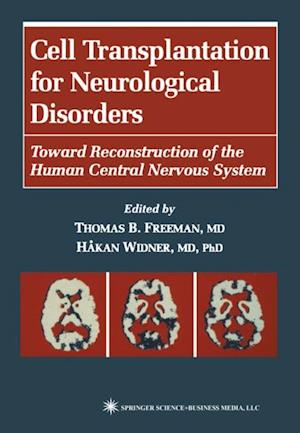 Cell Transplantation for Neurological Disorders