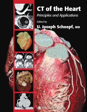 CT of the Heart