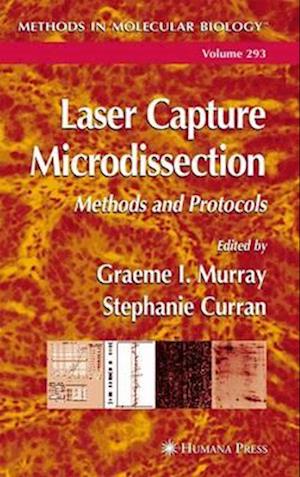 Laser Capture Microdissection