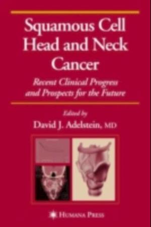 Squamous Cell Head and Neck Cancer