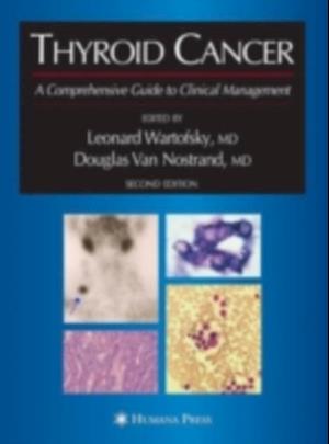 Thyroid Cancer