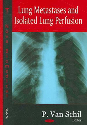 Lung Metastases & Isolated Lung Perfusion