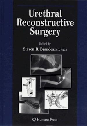 Urethral Reconstructive Surgery