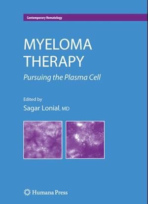 Myeloma Therapy