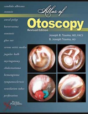 Atlas of Otoscopy