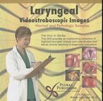 Laryngeal Videostroboscopic Images
