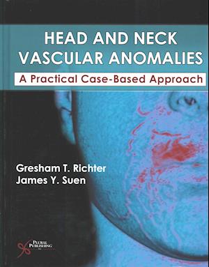 Head and Neck Vascular Anomalies