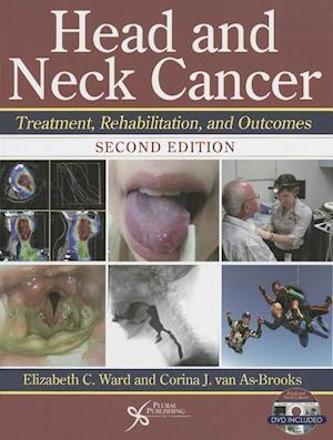 Head and Neck Cancer