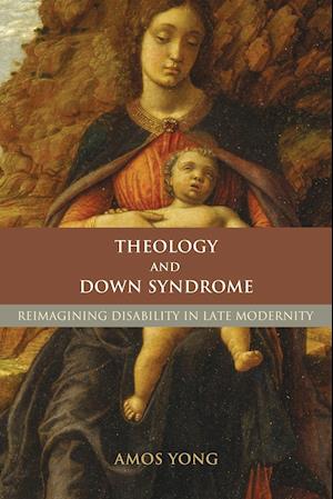 Theology and Down Syndrome