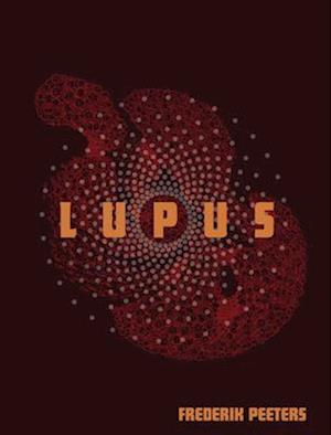 Lupus