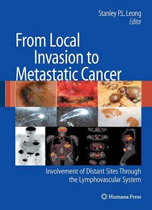 From Local Invasion to Metastatic Cancer